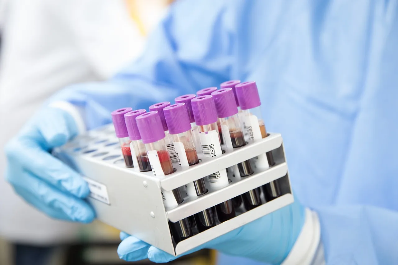 sample, lab, laboratory, scientist, medical, health, test, science, healthcare, research, tube, blue health, blue medical, blue science, blue research, blue lab, blue test, blue blood, blue laboratory, blue healthcare. Health research evidence types compared, from trials to case reports